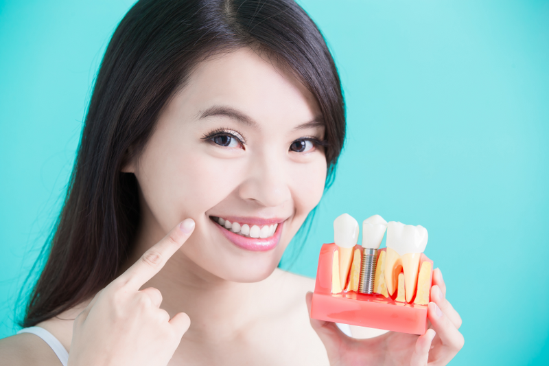 Dental Implants